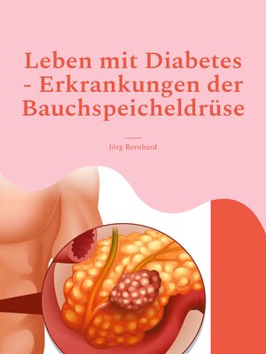 cover image of Leben mit Diabetes--Erkrankungen der Bauchspeicheldrüse